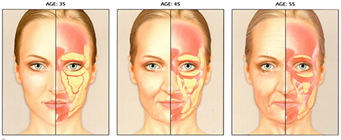 Facial-aging-Fat-loss